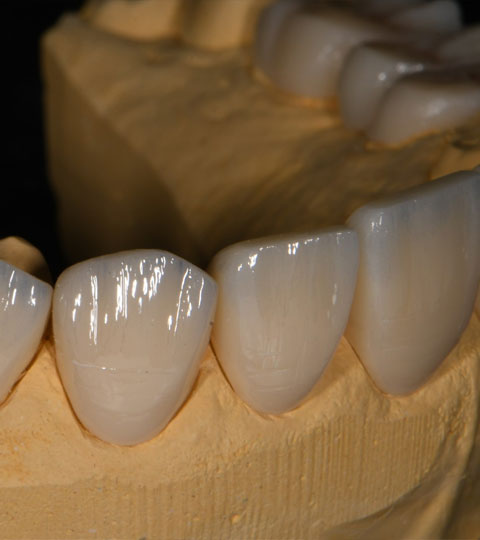 Benefits of Cosmetic Dentistry