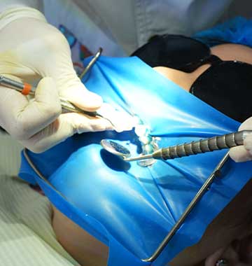 Root Canal Treatment