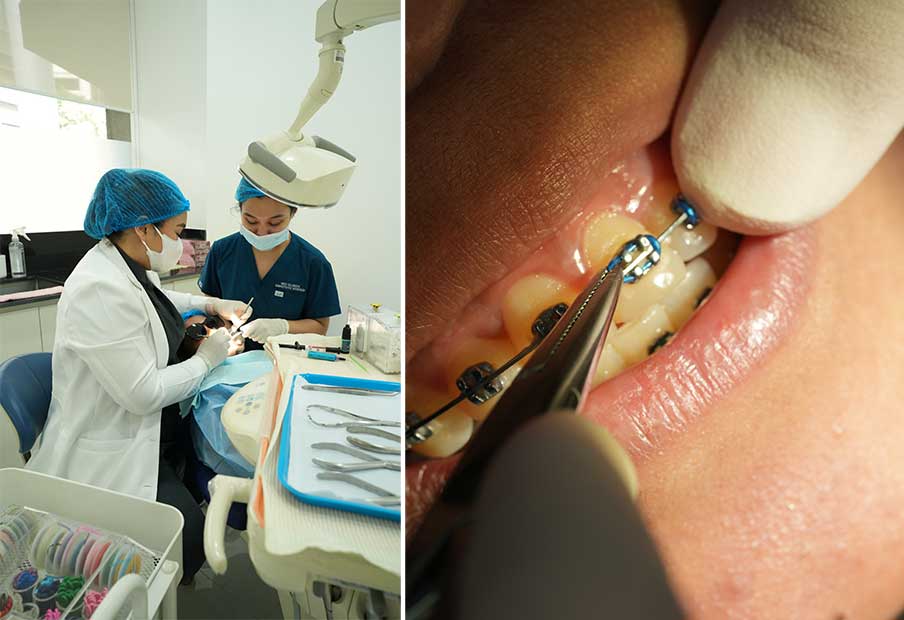 Orthodontics / Braces