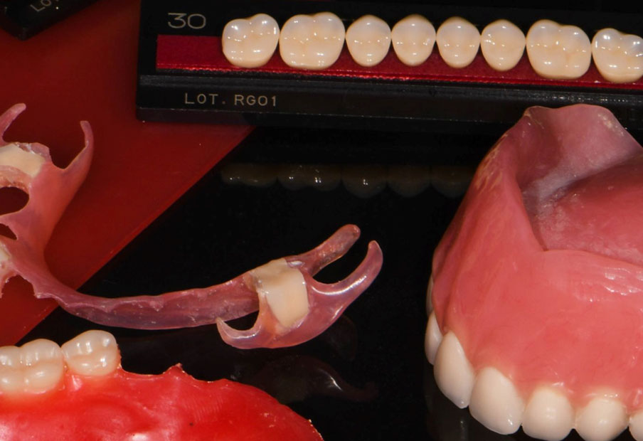Removable Dentures