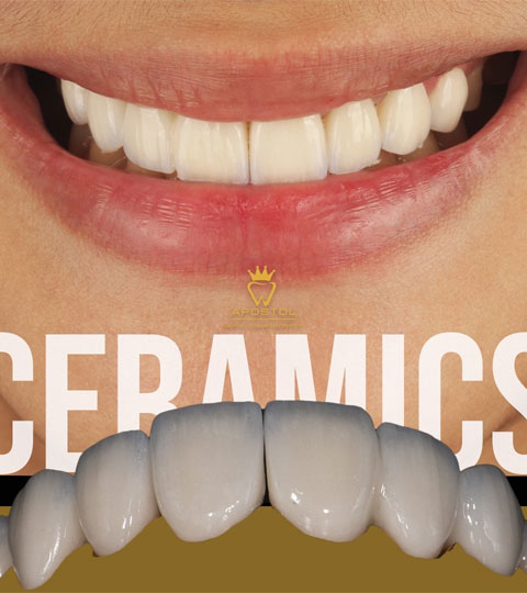 Common Myths About Getting a Dental Hollywood Smile